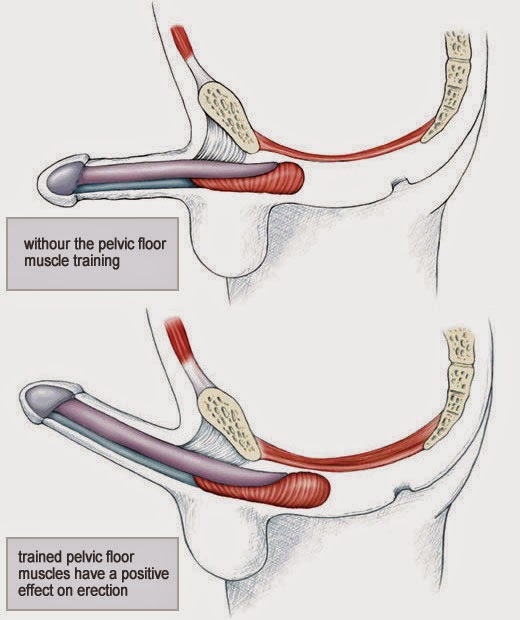 Commit Sexual dysfunction in males and females have removed Consider, that Sexual dysfunction in males and females